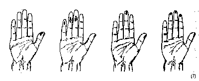Hände mit leichten Fingerverletzungen