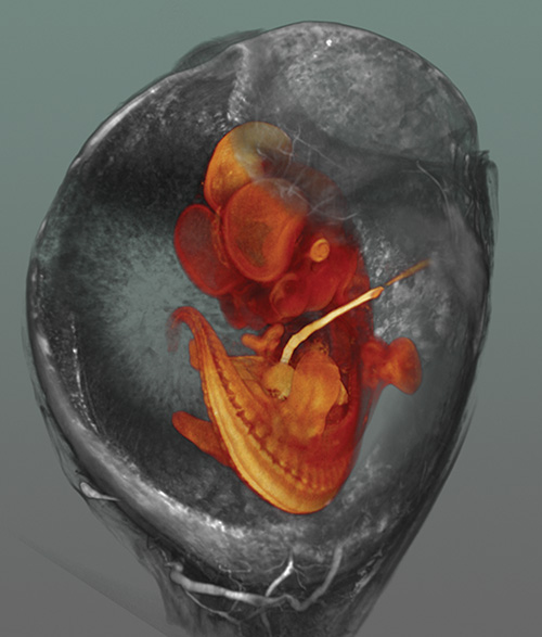 14d rat embryo